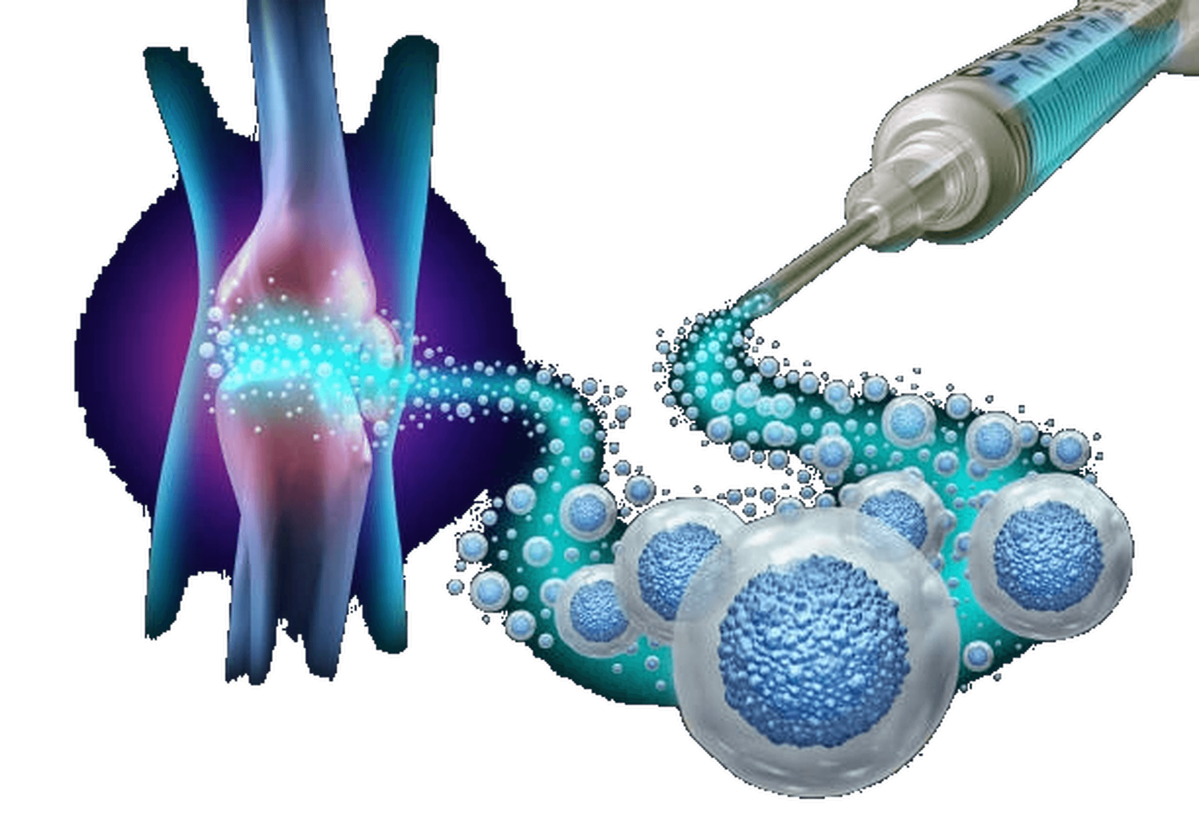 Stem cell therapy targeting a knee joint